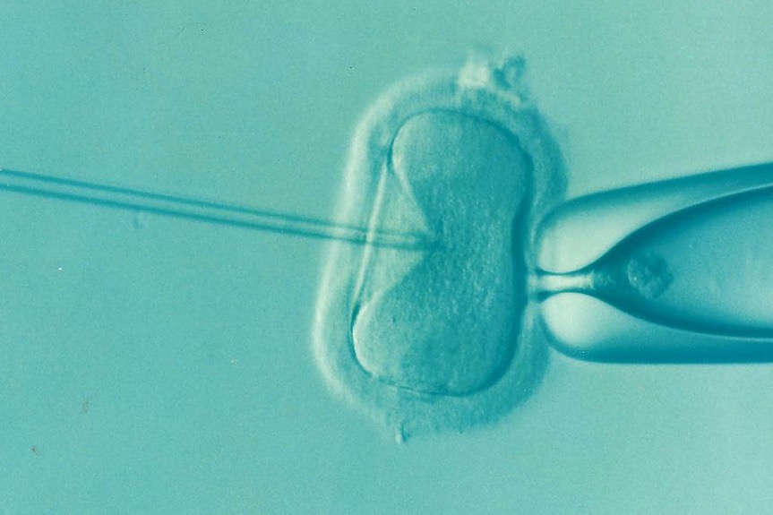 Dofinansowanie do in vitro dla mieszkańców Rzeszowa