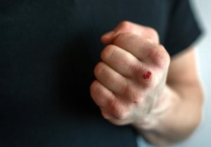 Policjanci ustalili i zatrzymali sprawców pobicia 21-latka w Jaśle