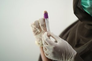Rzeszów sfinansuje kolejne badania dla mieszkańców